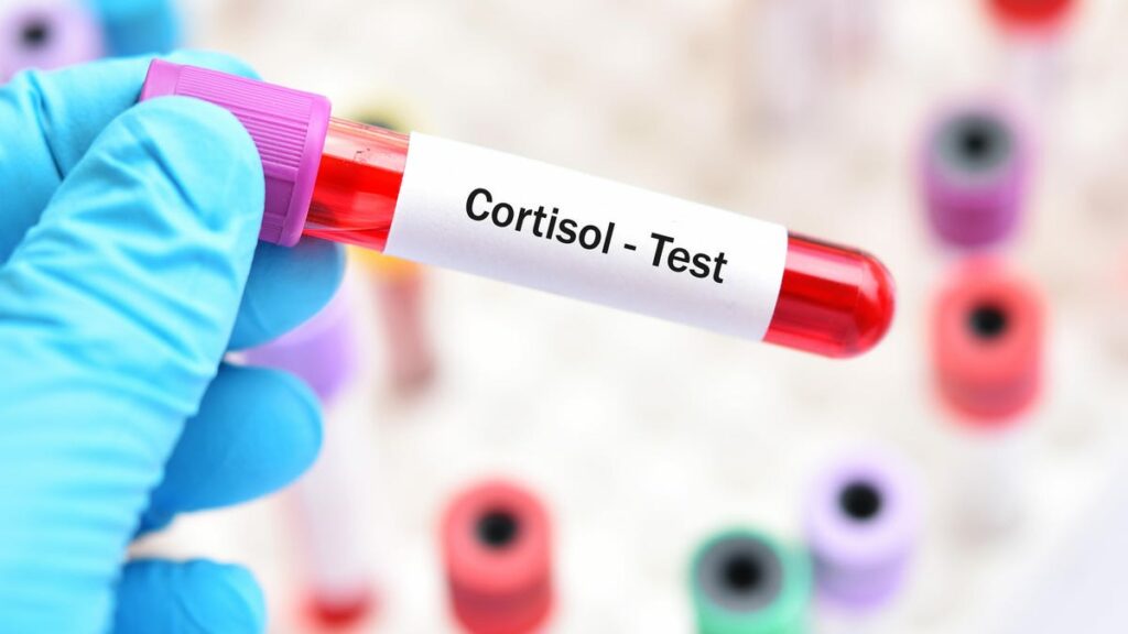 cortisol-blood-test