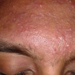 cover-image-96151